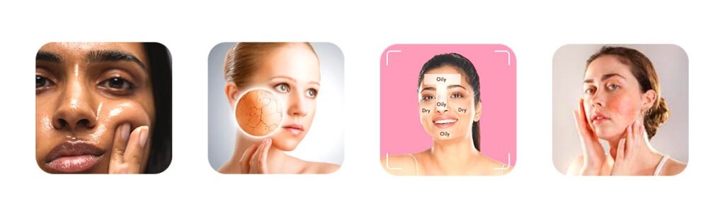 What Are the Different Skin Types