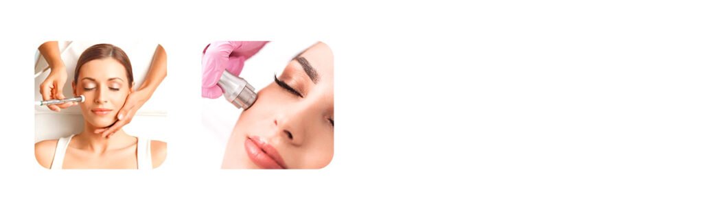 Microdermabrasion Facial