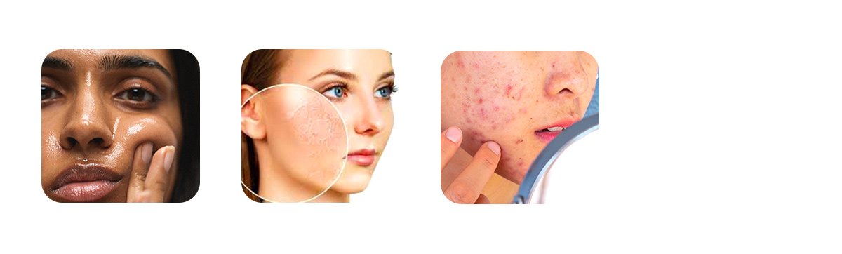 Skin Type Considerations 