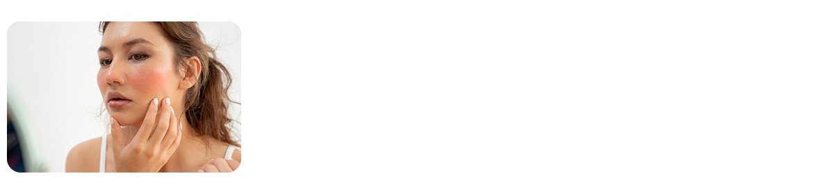 Allergies and Skin Irritation