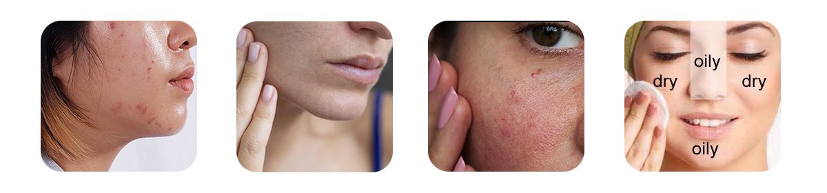 Choose the Right Toner for Your Skin Type