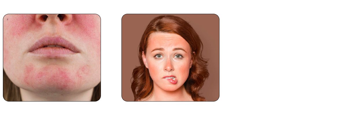 Mild Redness and Sensitivity