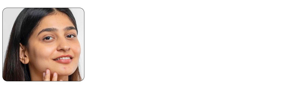 Enhancing skin hydration