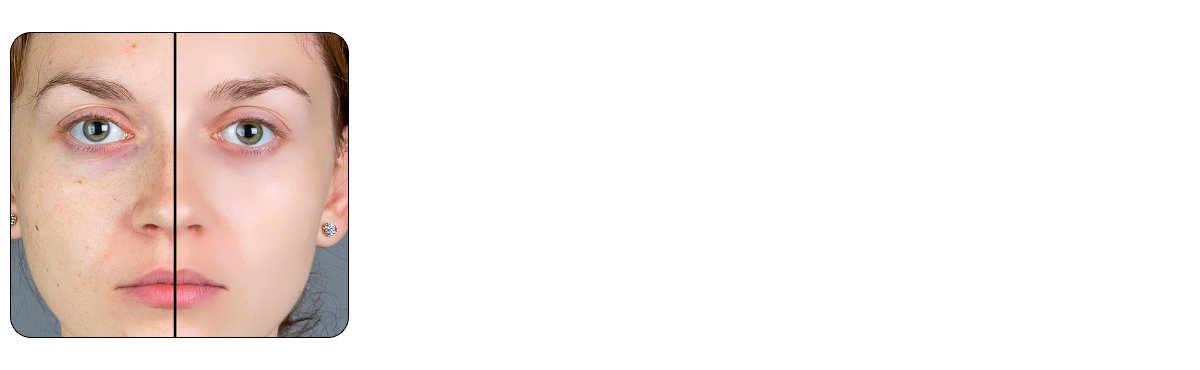 Improves Skin Texture and Tone