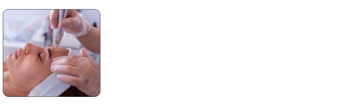 Microneedling for Skin Rejuvenation