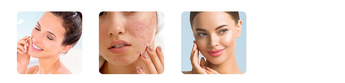 After Three Months and Beyond