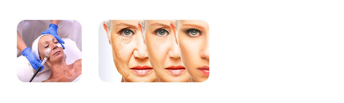 Anti-Aging Facial