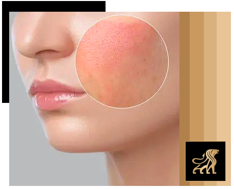 barrier repair boom main image