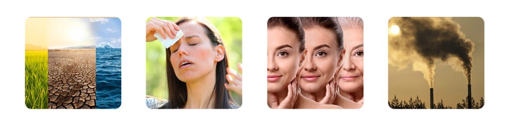 understanding dry skin