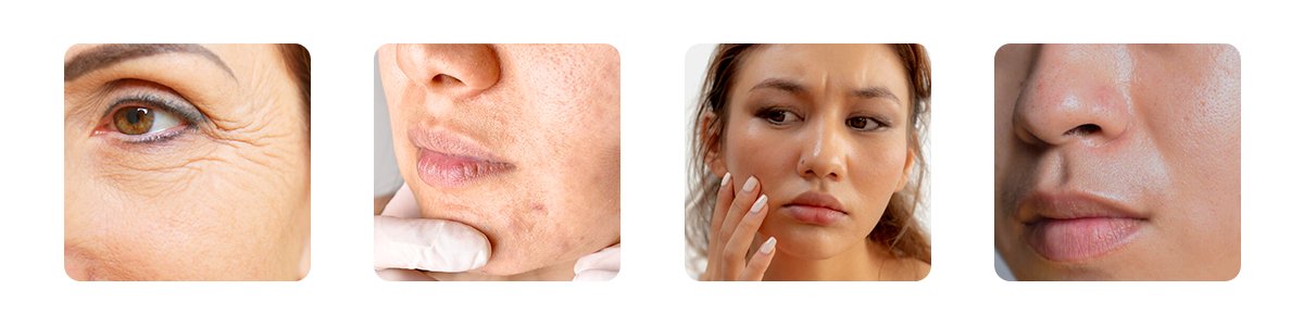 Who Can Benefit from a Hydrafacial