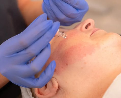 anti age md sub image