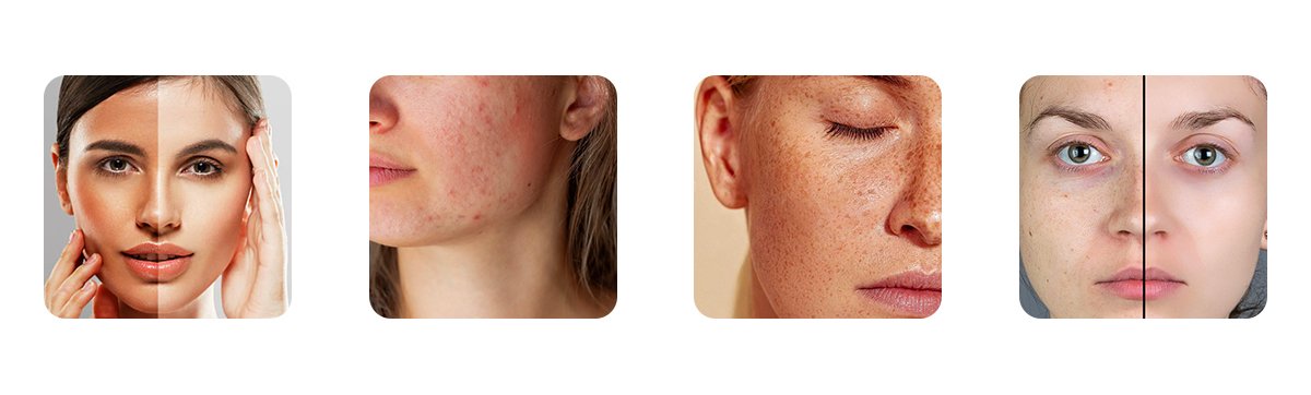 is bleach good for the skin