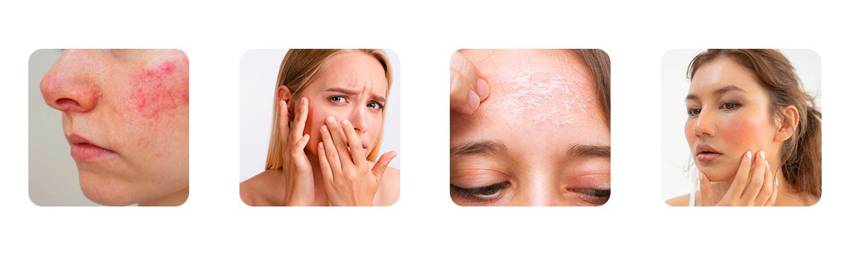 possible side effects of face bleach