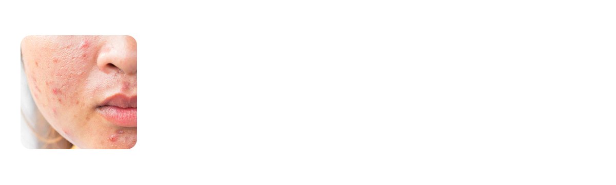 reduces the look of scars and marks