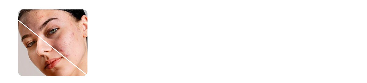 glycerine builds a strong skin barrier