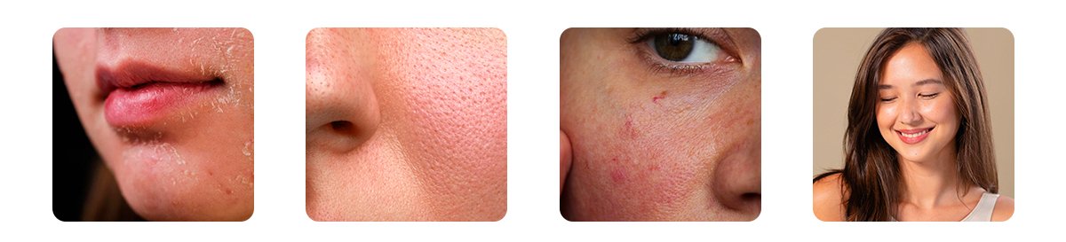 glycerine-gives-long-term-skin-benefits