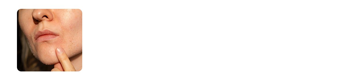 glycerine reduces flakiness and dry patches