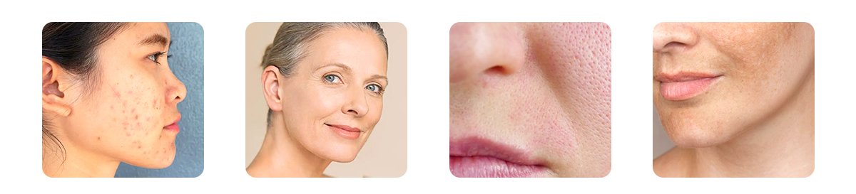 skin concerns we treat