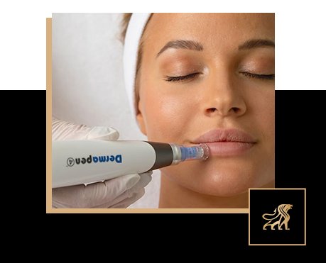 why we trust dermapen four at augusté skin main image