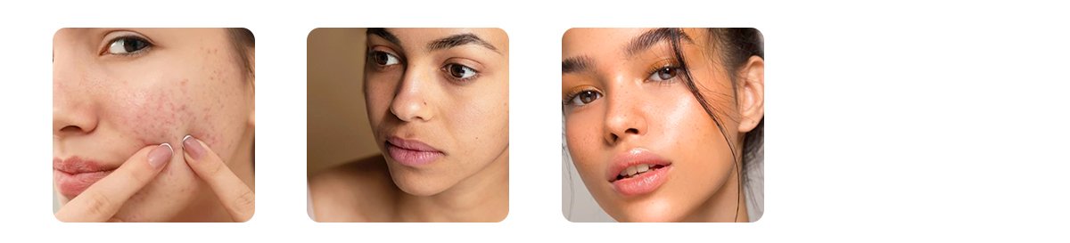 balances hormones naturally