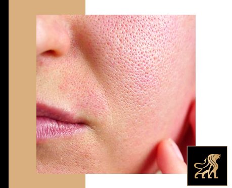 how to close pores on face