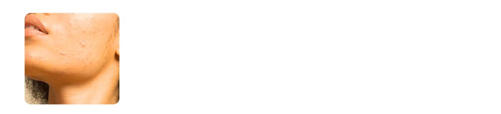 skin body and beyond