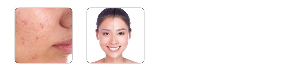 they’re rich in resistant starch and fiber