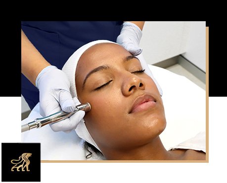 how microdermabrasion helps