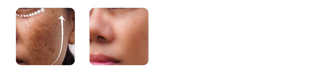 pigmentation cream and serums