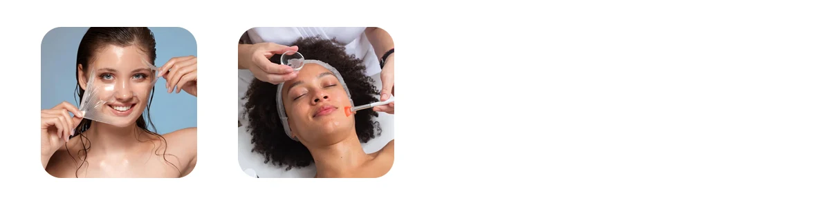 Chemical Peels