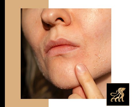 can dry skin make us age faster main image