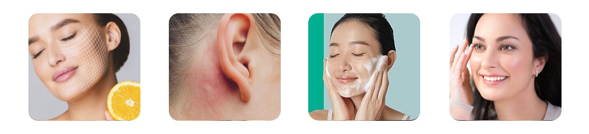 how to prevent breakouts when using vitamin c one to four