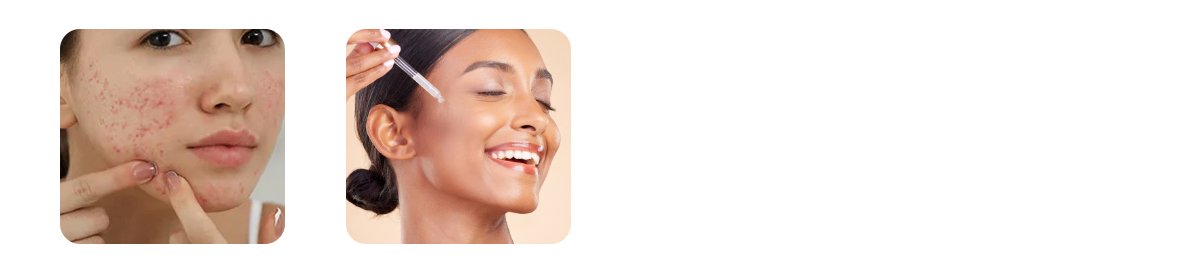 perfect duo for balanced skin