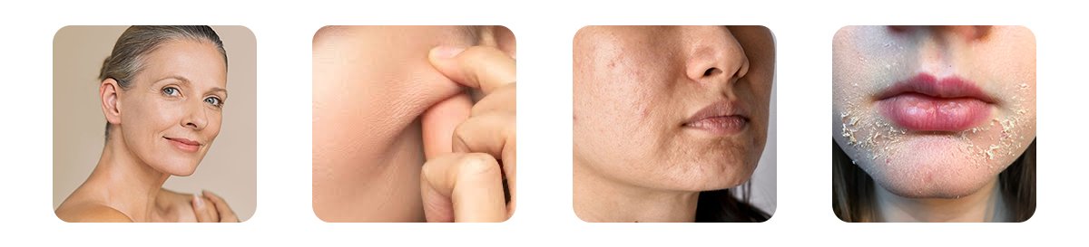 understanding the connection between dry skin and ageing