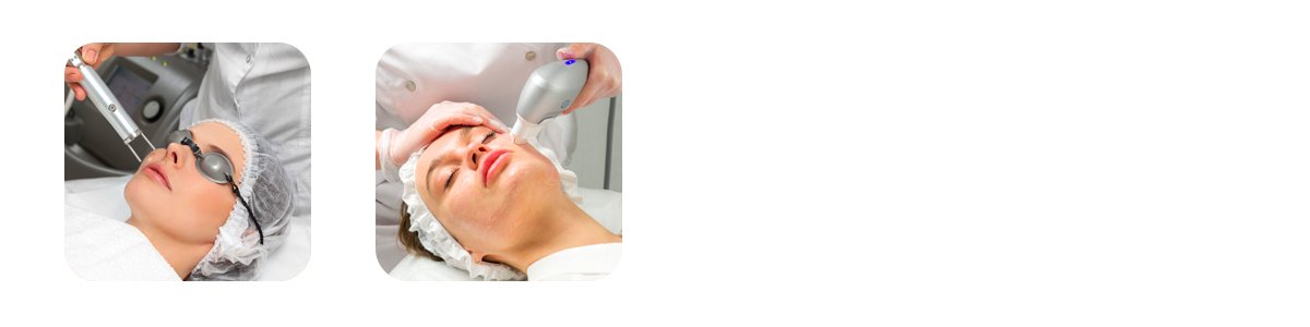 What Is a Q-Switch Laser