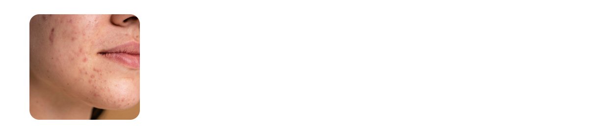 your skin barrier is compromised