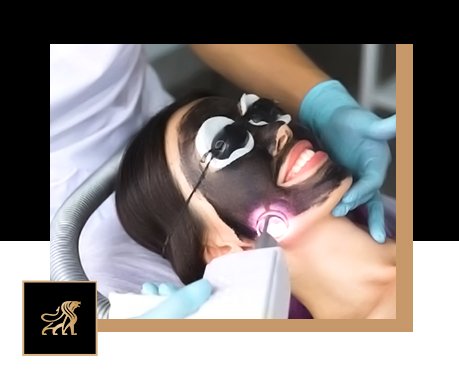 best-carbon-q-switch-laser-guide