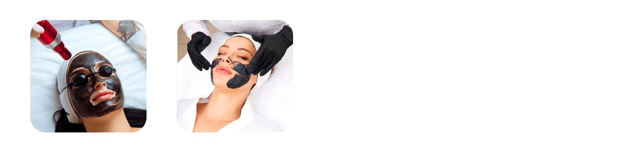 carbon-q-switch-laser