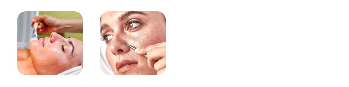 hollywood-glow-treatment