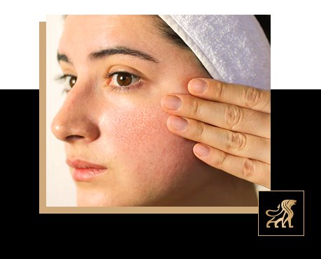 how to close open pores on facefor smooth