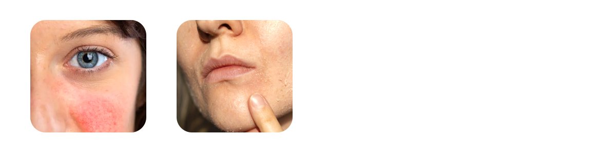 possible-side-effects