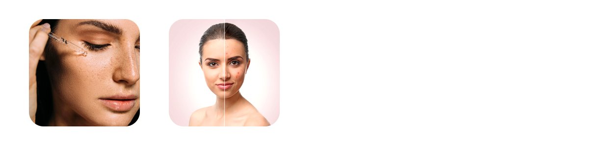 who-should-get-the-hollywood-glow-carbon-q-switch-laser