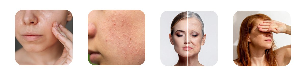 why do open pores appear on the face