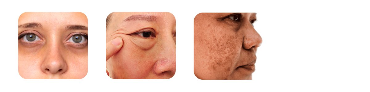 who is rejuran eye best for