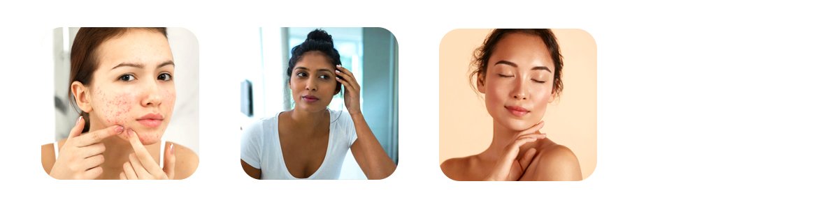 after two to three months