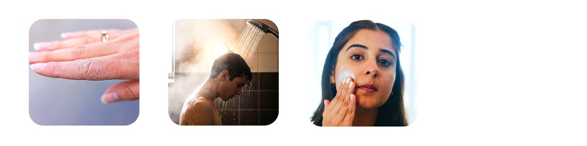 common winter triggers include