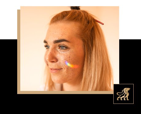 seasonal pigmentation flare ups science explained