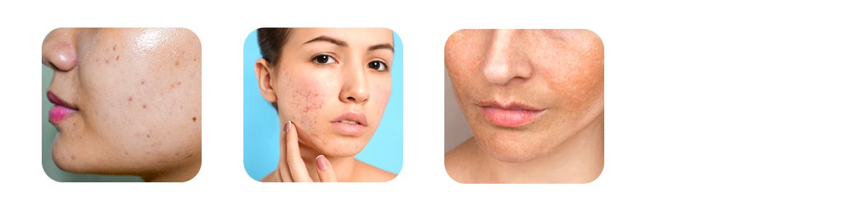 sugar and pigmentation problems