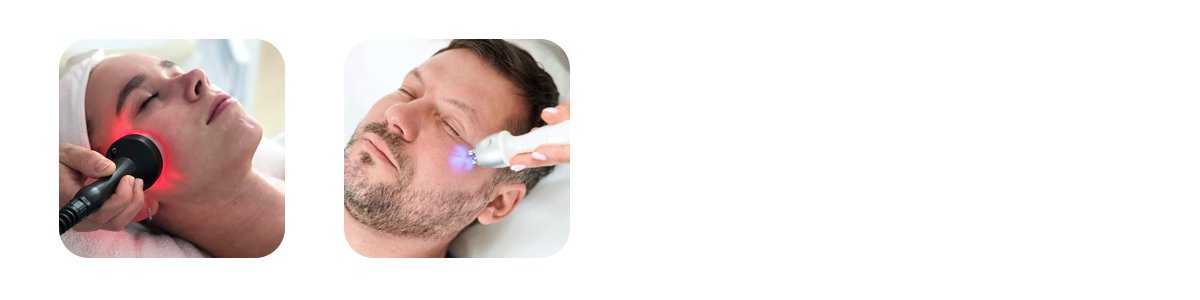 radiofrequency skin tightening