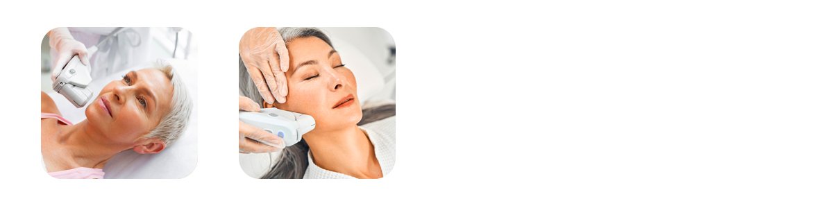 ultrasound skin lifting